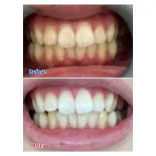 MBEAUTYSALON 千葉店・京成大久保所属・Melty 輝のその他イメージ