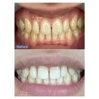 M渋谷店所属・M渋谷 ホワイトニングのエステ・リラクイメージ