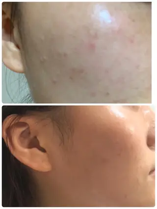 ダイエット／脱毛 美顔／フォト／ハーブのその他イメージ