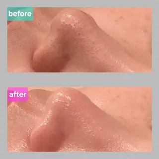 ベル チェリカ 三城のエステ・リラクイメージ