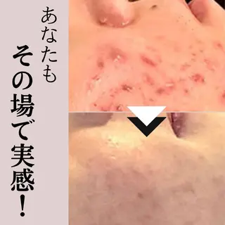 毛穴専門店Bebe 蘭のエステ・リラクイメージ