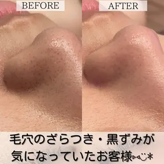 小顔、リフトアップ Lumière所属・小顔・美肌 ルミエールのエステ・リラクイメージ