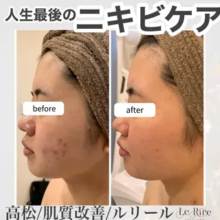 プライベートサロンLe Rire【ルリール】所属・美肌•小顔サロン ルリールのエステ・リラクイメージ