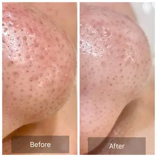 ガレリア　エステ　名駅所属・シオダ チコトのエステ・リラクイメージ