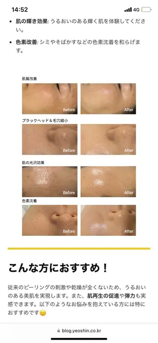 肌改善専門 浦和美園のエステ・リラクイメージ