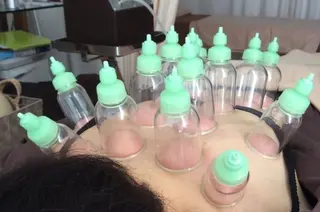 銀座そうぜん鍼灸院所属・不妊鍼灸専門 吉田ナミのエステ・リラクイメージ