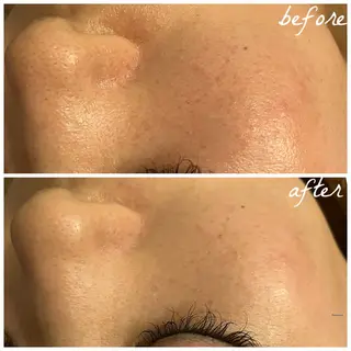 メンズ メナード岐阜市茜部 杉浦のエステ・リラクイメージ