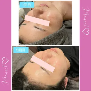 Monart -deux-のエステ・リラクイメージ