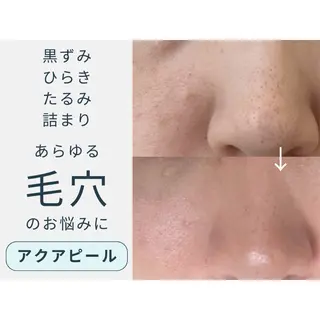 swan(スワン) 韓国肌管理 南堀江のエステ・リラクイメージ