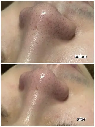 ENCHANT 脱毛.小顔.毛穴のエステ・リラクイメージ