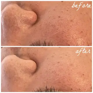 メンズ メナード岐阜市茜部 杉浦のエステ・リラクイメージ