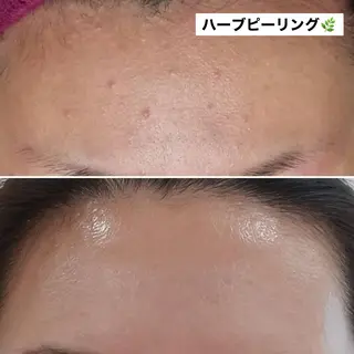 ネイル マツエク・マツパ アイブロウ Anacia Beauty Salon所属・美肌脱毛&毛穴専門 Anaciaのエステ・リラクイメージ