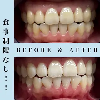 セルフホワイトニング Dolce水戸店のその他イメージ