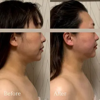 Lani Moon所属・⟡ 京都 小顔  ⊹ Lani Moonのエステ・リラクイメージ