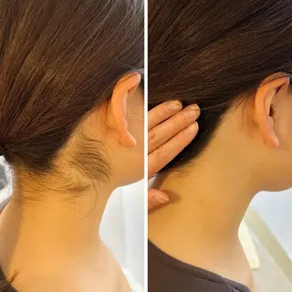 うなじ脱毛/美肌脱毛 LABELのエステ・リラクイメージ