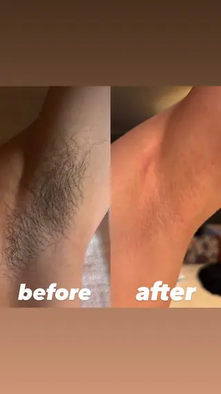 une所属・une シュガーリング脱毛のエステ・リラクイメージ