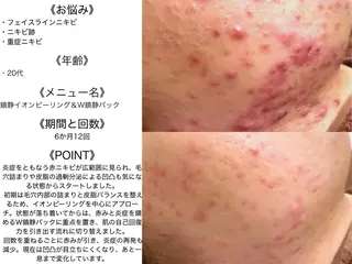 ニキビ・肌質改善専門 ♡人生が変わるサロンのエステ・リラクイメージ