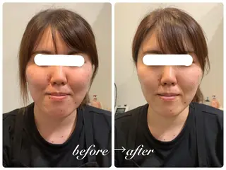 美肌脱毛専門店 イオンモール春日部店のエステ・リラクイメージ