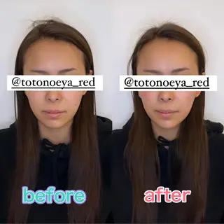 小顔矯正&美容整体 整え屋REDオーナーのエステ・リラクイメージ