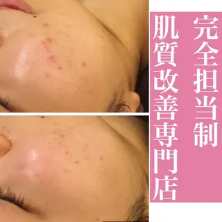 ミディアム カラー パーマ ヘアアレンジ メンズ ネイル マツエク・マツパ アイブロウ ニキビ・肌質改善専門 ♡人生が変わるサロンのエステ・リラクイメージ