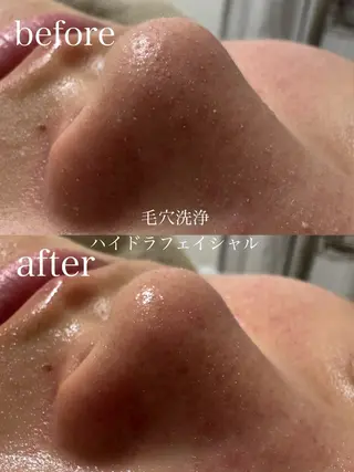 フェイシャルサロン CHIARA鈴木のエステ・リラクイメージ