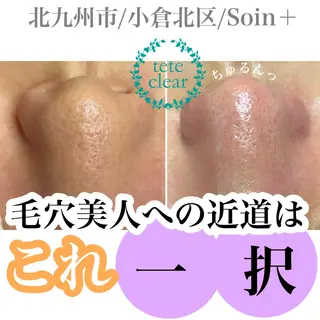 Soin＋ みきのエステ・リラクイメージ