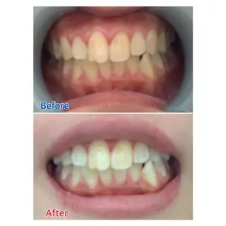 M渋谷店所属・Ｍ渋谷 ホワイトニングのエステ・リラクイメージ