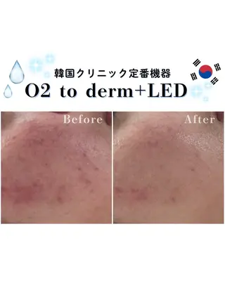 HETIY by Seoul所属・韓国肌管理🇰🇷 水光肌/肌質改善🫧のエステ・リラクイメージ