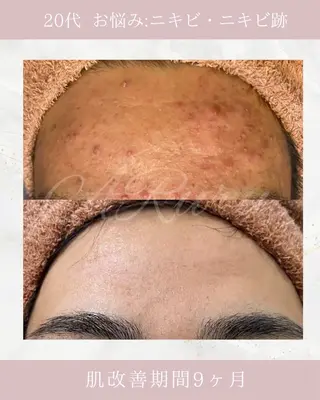 メンズ ARuru所属・ARuru 本店のエステ・リラクイメージ