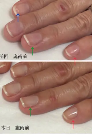 ネイル Alo.nail アロ•ネイルのネイルデザイン