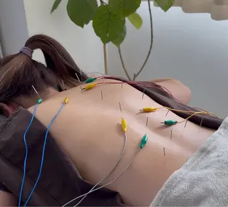 美容鍼＆鍼灸サロン 鍼Glitter.所属・田中 美奈のエステ・リラクイメージ