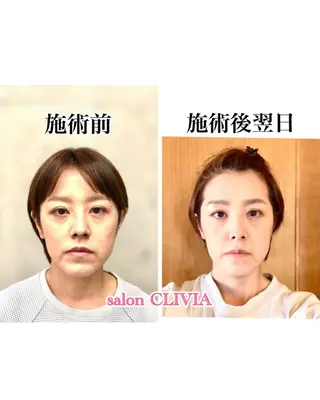 salon CLIVIA, クリヴィア所属・無痛小顔矯正 クリヴィアのエステ・リラクイメージ