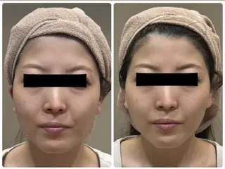 レイビス名古屋♡ 川北のエステ・リラクイメージ