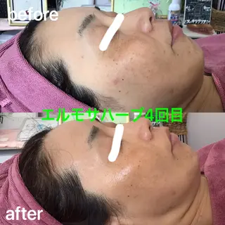 氣楽所属・松下 さゆりのエステ・リラクイメージ