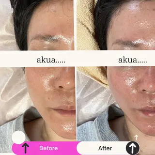akua... 【肌質管理専門】のその他イメージ