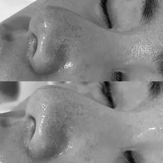 private salon éclat所属・ニキビ・毛穴専門 éclat/エクラのエステ・リラクイメージ