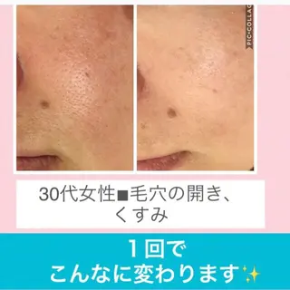 ミディアム カラー パーマ ヘアアレンジ メンズ キッズ ネイル マツエク・マツパ ニキビ・肌質改善専門 ♡人生が変わるサロンのエステ・リラクイメージ