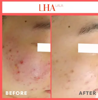 肌質改善エステ chiffonのエステ・リラクイメージ