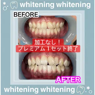 LAVISH nail salonのネイルデザイン