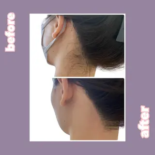 【痩身・脱毛サロン】 REBISKIN🌱のエステ・リラクイメージ