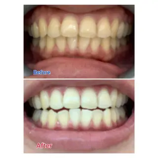 MBEAUTYSALON 千葉店・京成大久保所属・Melty 輝のその他イメージ