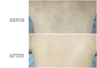 Lys Blancのエステ・リラクイメージ