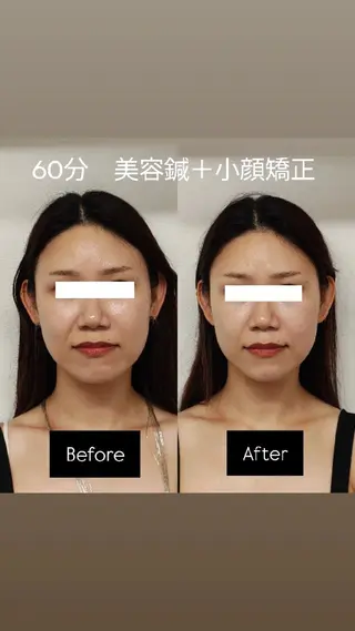 美容鍼灸サロンAria所属・美容鍼サロンAria 杉元みつるのエステ・リラクイメージ