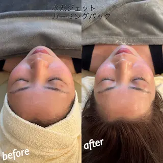 うなじ脱毛/美肌脱毛 LABELのエステ・リラクイメージ