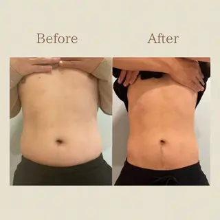 お腹痩せエステ Flat BELLY 恵比寿所属・【腸もみ/冷却痩身】 お腹エステ/恵比寿のエステ・リラクイメージ