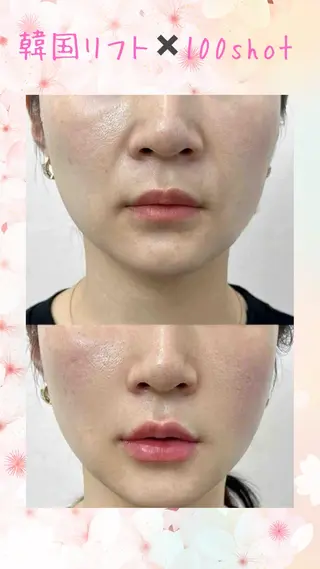 マツエク・マツパ 愛維美水光美肌専門店所属・愛維美水光美肌専門店 メンズレディースokのエステ・リラクイメージ