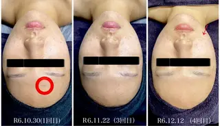 Genesis Plus大津京店のエステ・リラクイメージ