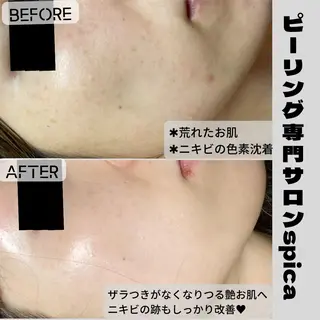 ピーリング専門サロン Spicaのエステ・リラクイメージ