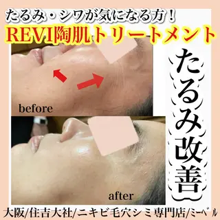 salon  mebell所属・肌管理専門店 mebell天王寺店のエステ・リラクイメージ