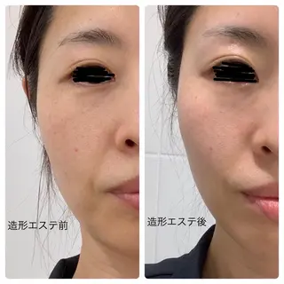 💆‍♀️松田 亜沙美のエステ・リラクイメージ